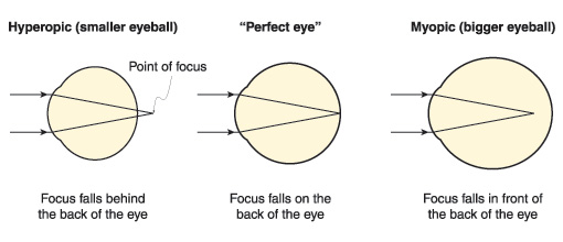 point-of-focus.jpg